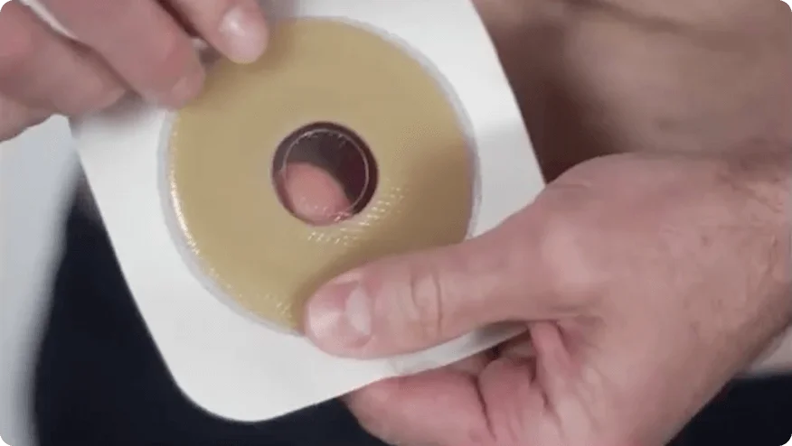 A video thumbnail of '2-piece Application Instructions Convatec Moldable Technology™'