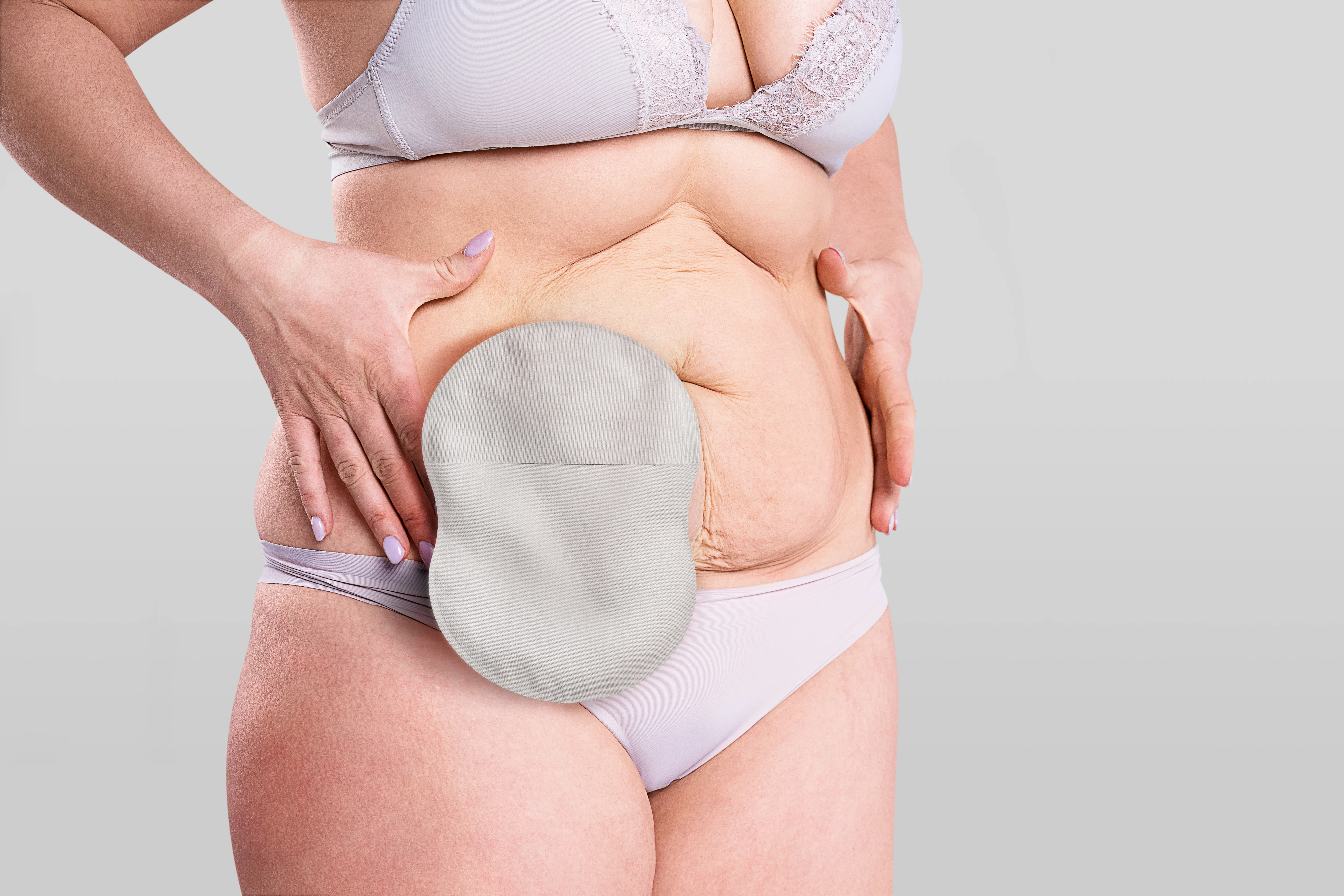 woman wearing an Esteem Body™ stoma pouch standing