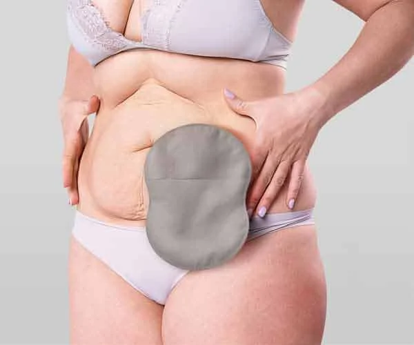 New Esteem Body