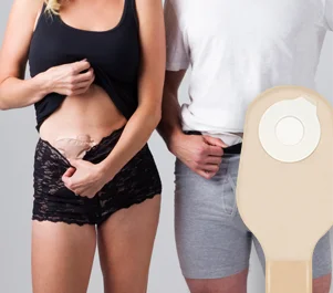 a man and a woman showing their ostomy pouches